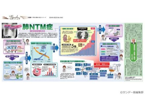 急増!肺NTM(非結核性抗酸菌)症(No.1665)(2024年6月2日)