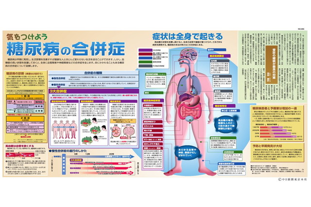 気をつけよう　糖尿病の合併症(No.895)(2009年6月28日)